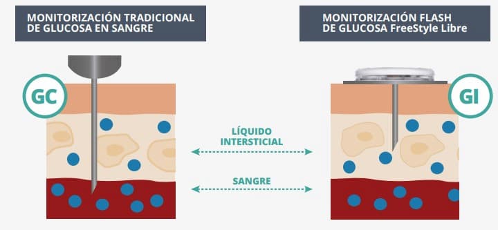 monitorizacion-freestyle-que-es-glucosa-intersticial monitorizacion-freestyle-que-es-glucosa-intersticial